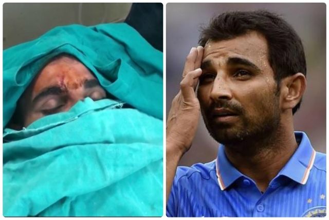 Cricketer Shami injured in road accident