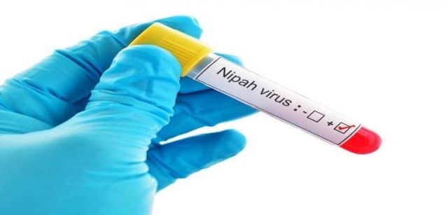 Nipah-virus.jpg